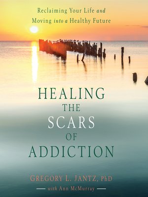 cover image of Healing the Scars of Addiction